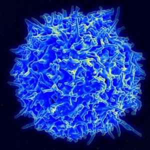 Imagen de un linfocito T visto con microscopio electrónico. • Imagen: Wikimedia Commons.